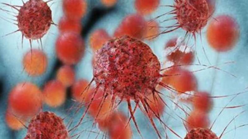 Nipah virus claims lives in Kerala