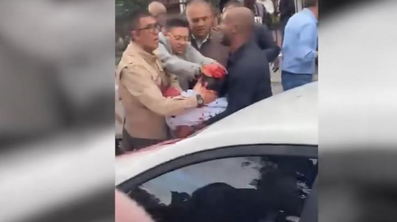 Colombian Presidential Candidate Miguel Uribe Shot During Rally, Suspect Detained