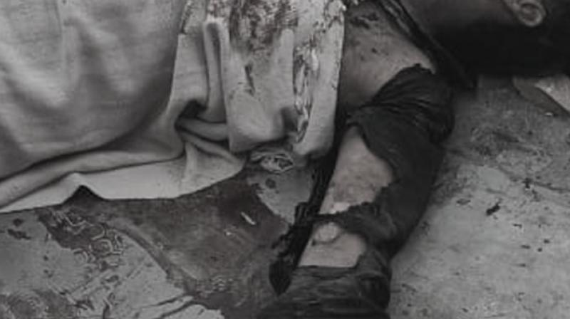 Punjab News: Major Accident While Loading Gunpowder into Potash Gun, 24-Year-Old Youth in Critical Condition