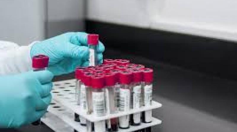 Their innovative “cell algebra” approach enables virtual modelling of cell compositions to pinpoint the most lethal cancer cells and improve therapeutic prioritisation. File Photo.