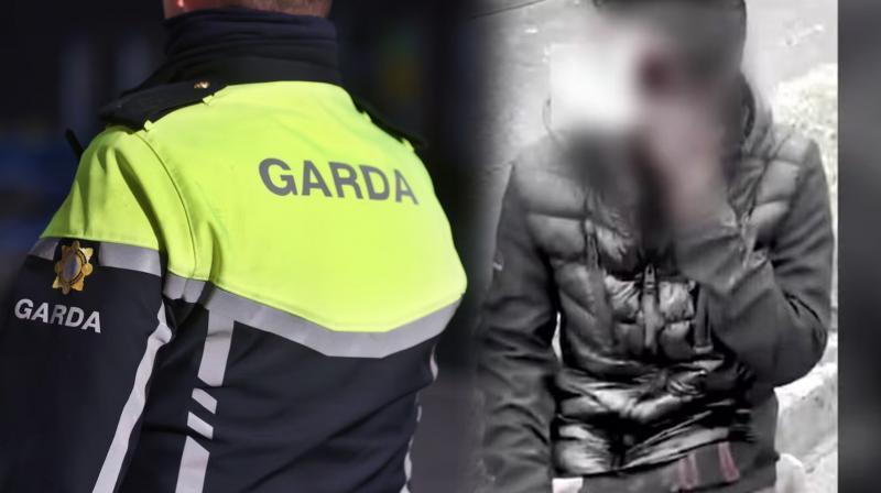 Ireland: Indian Assaulted, Stripped, and Left Bleeding by 'Racist Gang' Armed with Bladed Knuckles