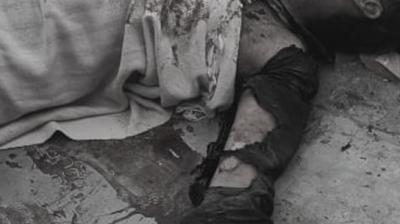 Punjab News: Major Accident While Loading Gunpowder into Potash Gun, 24-Year-Old Youth in Critical Condition