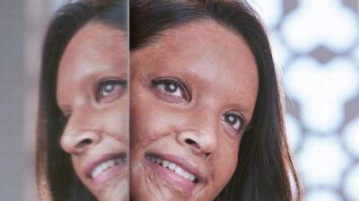 Malti will stay with me forever: Deepika shares her first look from 'Chhapaak'